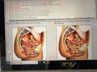メタトロンのお客様本日２名　１日の予約は３名様まで